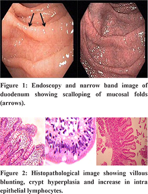 celiac normal